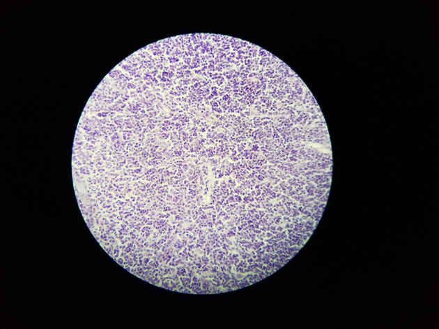 Thymus Slides - Thymus 010 400X